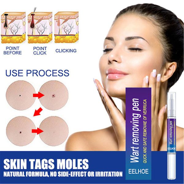 Wart Remover Gel Pen Fast & Effective